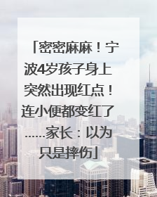 密密麻麻！宁波4岁孩子身上突然出现红点！连小便都变红了……家长：以为只是摔伤